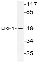 LRP1 Rabbit Polyclonal Antibody - image 1