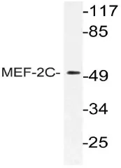 MEF2C Rabbit Polyclonal Antibody - image 1