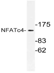 NFATC4 Rabbit Polyclonal Antibody - image 1