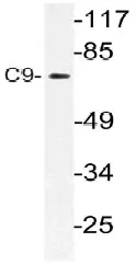 Complement C9 (C9) Rabbit Polyclonal Antibody - image 1