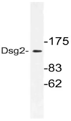 Desmoglein 2 (DSG2) Rabbit Polyclonal Antibody - image 1
