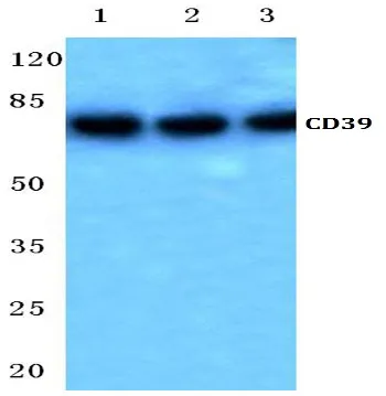 CD39 (ENTPD1) Rabbit Polyclonal Antibody - image 1
