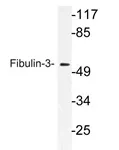 EFEMP1 Rabbit Polyclonal Antibody - image 1