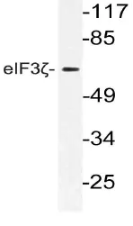 EIF3D Rabbit Polyclonal Antibody - image 1
