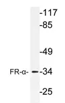 Folate Binding Protein (FOLR1) Rabbit Polyclonal Antibody - image 1