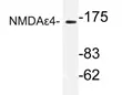 Glutamate receptor ionotropic, NMDA 2D (GRIN2D) Rabbit Polyclonal Antibody - image 1
