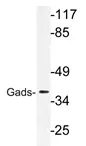 GRAP2 Rabbit Polyclonal Antibody - image 1