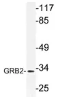GRB2 Rabbit Polyclonal Antibody - image 1