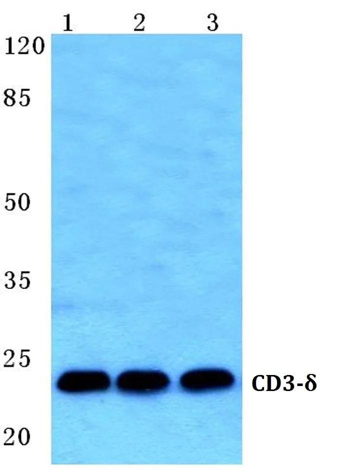 CD3D Rabbit Polyclonal Antibody - image 1