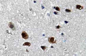 SCN2A Rabbit Polyclonal Antibody - image 1