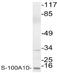 S100A10 Rabbit Polyclonal Antibody - image 1