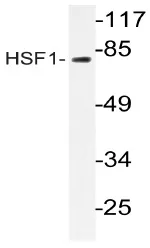 HSF1 Rabbit Polyclonal Antibody - image 1