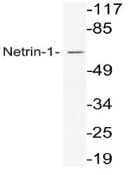 Netrin 1 (NTN1) Rabbit Polyclonal Antibody - image 1