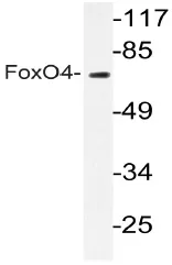 FOXO4 Rabbit Polyclonal Antibody - image 1