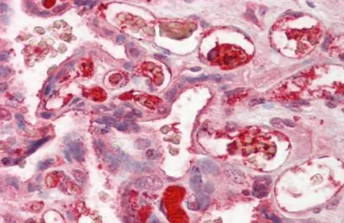 Complement C3 (C3) Goat Polyclonal Antibody - image 1