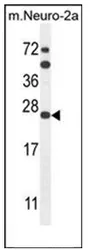 SCN1B (N-term) Rabbit Polyclonal Antibody - image 1