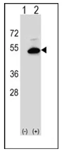 Sphingomyelin Synthase 2 (SGMS2) (C-term) Rabbit Polyclonal Antibody - image 1