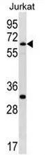 SMARCD1 (C-term) Rabbit Polyclonal Antibody - image 1