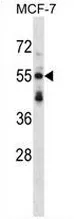 Syntrophin (SNTB2) (Center) Rabbit Polyclonal Antibody - image 1