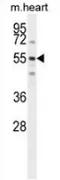 SPATC1 (N-term) Rabbit Polyclonal Antibody - image 1