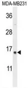 SPRR2A (C-term) Rabbit Polyclonal Antibody - image 1