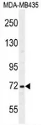 SRBD1 (C-term) Rabbit Polyclonal Antibody - image 1