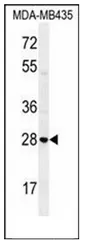 STX19 (C-term) Rabbit Polyclonal Antibody - image 1