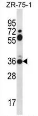 Syntaxin 2 (STX2) (Center) Rabbit Polyclonal Antibody - image 1