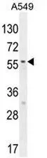 SYNC (N-term) Rabbit Polyclonal Antibody - image 1