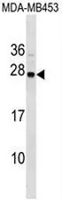 Synaptogyrin 1 (SYNGR1) (C-term) Rabbit Polyclonal Antibody - image 1
