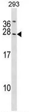Synaptogyrin 2 (SYNGR2) (N-term) Rabbit Polyclonal Antibody - image 1
