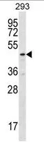 TBCEL (C-term) Rabbit Polyclonal Antibody - image 1