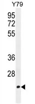 TCEAL3 (N-term) Rabbit Polyclonal Antibody - image 1
