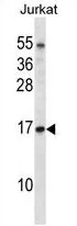ELOC (C-term) Rabbit Polyclonal Antibody - image 1