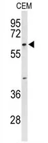 TCHP (Center) Rabbit Polyclonal Antibody - image 1