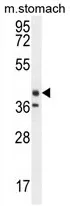 TECTB (N-term) Rabbit Polyclonal Antibody - image 1
