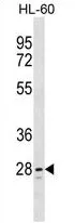 TLCD1 (C-term) Rabbit Polyclonal Antibody - image 1