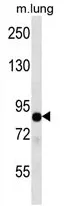 TLE2 (C-term) Rabbit Polyclonal Antibody - image 1
