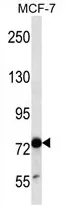 TLE4 (N-term) Rabbit Polyclonal Antibody - image 1