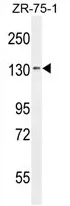 TLL1 (C-term) Rabbit Polyclonal Antibody - image 1