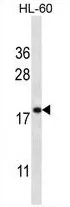 TMEM70 (C-term) Rabbit Polyclonal Antibody - image 1