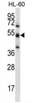 TOE1 (N-term) Rabbit Polyclonal Antibody - image 1