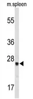 TPK1 (N-term) Rabbit Polyclonal Antibody - image 1