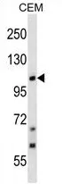TRP 7 (TRPC7) (C-term) Rabbit Polyclonal Antibody - image 1
