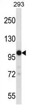 TRPM4 (C-term) Rabbit Polyclonal Antibody - image 1