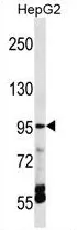 TRPV5 (C-term) Rabbit Polyclonal Antibody - image 1