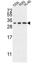 TSPAN2 (Center) Rabbit Polyclonal Antibody - image 1