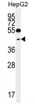 TXNL2 (GLRX3) (N-term) Rabbit Polyclonal Antibody - image 1