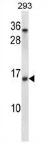 UBE2D2 (C-term) Rabbit Polyclonal Antibody - image 1