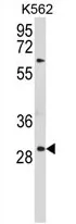 Uroplakin Ib (UPK1B) (Center) Rabbit Polyclonal Antibody - image 1